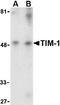 HAVcr-1 antibody, LS-B2463, Lifespan Biosciences, Western Blot image 