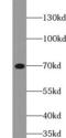 Mitochondrial Antiviral Signaling Protein antibody, FNab05032, FineTest, Western Blot image 