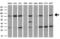 Myotubularin-related protein 2 antibody, M04202, Boster Biological Technology, Western Blot image 
