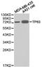 Tumor Protein P63 antibody, LS-C192942, Lifespan Biosciences, Western Blot image 