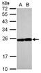 RAB17, Member RAS Oncogene Family antibody, NBP2-20036, Novus Biologicals, Western Blot image 