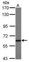 Protein TBRG4 antibody, GTX107663, GeneTex, Western Blot image 