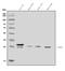 Glutathione S-Transferase Alpha 4 antibody, A03699-2, Boster Biological Technology, Western Blot image 