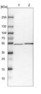 3-Oxoacyl-ACP Synthase, Mitochondrial antibody, NBP1-84732, Novus Biologicals, Western Blot image 