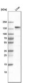 Collagen alpha-2(VI) chain antibody, HPA007029, Atlas Antibodies, Western Blot image 