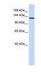 Valyl-TRNA Synthetase antibody, NBP1-55365, Novus Biologicals, Western Blot image 