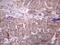 Doublesex And Mab-3 Related Transcription Factor 1 antibody, M02311-1, Boster Biological Technology, Immunohistochemistry paraffin image 