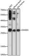 Dehydrodolichyl Diphosphate Synthase Subunit antibody, 23-216, ProSci, Western Blot image 