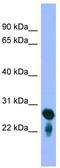 Ras-related protein Rab-5C antibody, TA344585, Origene, Western Blot image 