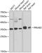 Protein Kinase AMP-Activated Non-Catalytic Subunit Beta 2 antibody, A05077, Boster Biological Technology, Western Blot image 