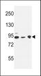 DnaJ Heat Shock Protein Family (Hsp40) Member C6 antibody, 64-222, ProSci, Western Blot image 