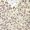 DNA replication licensing factor MCM6 antibody, 18-412, ProSci, Immunohistochemistry paraffin image 