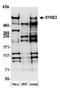 SYNE2 antibody, A305-393A, Bethyl Labs, Western Blot image 