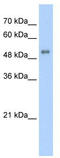 5'-Aminolevulinate Synthase 2 antibody, TA346264, Origene, Western Blot image 