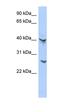 ATPase H+ Transporting V1 Subunit E2 antibody, orb325704, Biorbyt, Western Blot image 