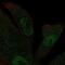 Kinesin Family Member 12 antibody, PA5-54161, Invitrogen Antibodies, Immunofluorescence image 