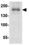 Probable E3 ubiquitin-protein ligase TRIP12 antibody, GTX32138, GeneTex, Western Blot image 