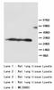 Pulmonary surfactant-associated protein A1 antibody, LS-C172196, Lifespan Biosciences, Western Blot image 