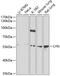 LYN Proto-Oncogene, Src Family Tyrosine Kinase antibody, 18-494, ProSci, Western Blot image 