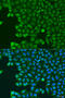 ATP Binding Cassette Subfamily E Member 1 antibody, 23-432, ProSci, Immunofluorescence image 
