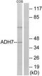 Alcohol Dehydrogenase 7 (Class IV), Mu Or Sigma Polypeptide antibody, TA313318, Origene, Western Blot image 