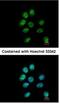 Zinc finger protein 143 antibody, NBP1-32104, Novus Biologicals, Immunofluorescence image 