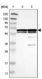 Heterogeneous Nuclear Ribonucleoprotein K antibody, NBP1-84374, Novus Biologicals, Western Blot image 