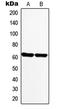 Monoamine Oxidase A antibody, LS-C352487, Lifespan Biosciences, Western Blot image 