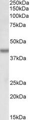 Alpha Fetoprotein antibody, 43-556, ProSci, Enzyme Linked Immunosorbent Assay image 