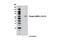 Protein Kinase AMP-Activated Catalytic Subunit Alpha 1 antibody, 5256S, Cell Signaling Technology, Western Blot image 