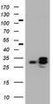 Palmitoyl-Protein Thioesterase 1 antibody, TA800501BM, Origene, Western Blot image 
