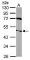 Zinc Finger C3HC-Type Containing 1 antibody, GTX111740, GeneTex, Western Blot image 