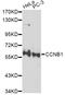 Cyclin B1 antibody, STJ22943, St John