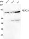 Phosphoenolpyruvate Carboxykinase 2, Mitochondrial antibody, STJ98530, St John