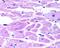 HIF-2-alpha antibody, PA5-22693, Invitrogen Antibodies, Immunohistochemistry frozen image 