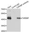 TAR DNA Binding Protein antibody, orb49083, Biorbyt, Immunoprecipitation image 