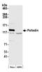 Palladin, Cytoskeletal Associated Protein antibody, A304-507A, Bethyl Labs, Western Blot image 