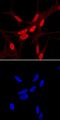Homeobox B13 antibody, AF8156, R&D Systems, Immunocytochemistry image 