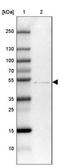 Zinc Finger DHHC-Type Containing 1 antibody, NBP2-13539, Novus Biologicals, Western Blot image 