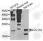 Biogenesis Of Lysosomal Organelles Complex 1 Subunit 2 antibody, A8007, ABclonal Technology, Western Blot image 