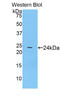 Prostaglandin-Endoperoxide Synthase 1 antibody, LS-C296073, Lifespan Biosciences, Western Blot image 