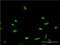 Cone-Rod Homeobox antibody, H00001406-M06, Novus Biologicals, Immunocytochemistry image 