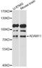 Disintegrin and metalloproteinase domain-containing protein 11 antibody, LS-C749253, Lifespan Biosciences, Western Blot image 
