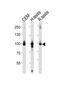 ArfGAP With Coiled-Coil, Ankyrin Repeat And PH Domains 2 antibody, M09294, Boster Biological Technology, Western Blot image 