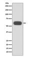 GBA antibody, M01162, Boster Biological Technology, Western Blot image 