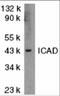 DNA Fragmentation Factor Subunit Alpha antibody, 2001, ProSci Inc, Western Blot image 