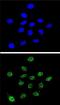 Dyskerin Pseudouridine Synthase 1 antibody, PA5-25393, Invitrogen Antibodies, Immunofluorescence image 