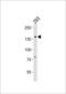 SPIN antibody, LS-C159799, Lifespan Biosciences, Western Blot image 