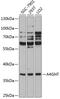 Alpha-1,4-N-Acetylglucosaminyltransferase antibody, A13668, Boster Biological Technology, Western Blot image 