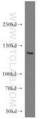 Adhesion G Protein-Coupled Receptor B3 antibody, 19789-1-AP, Proteintech Group, Western Blot image 